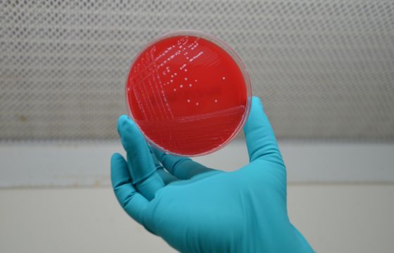 dealing-with-clinical-bovine-mastitis-in-dairy-cattle