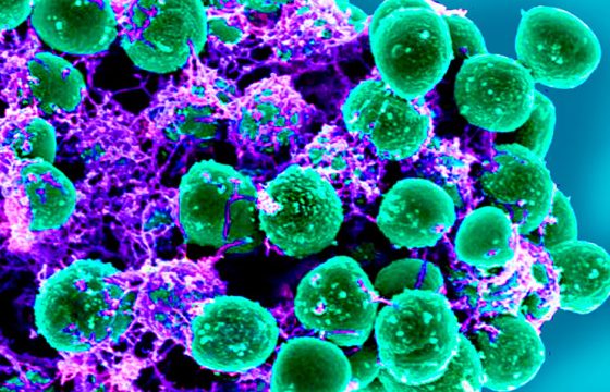 non-aureus-staphylococci-bovine-mastitis-B